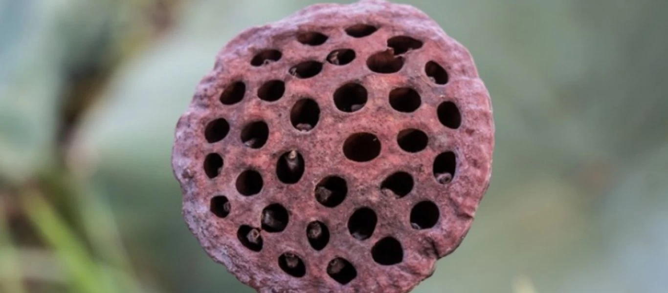 Τρυποφοβία: Τι είναι και γιατί συμβαίνει - Όλα τα συμπτώματα